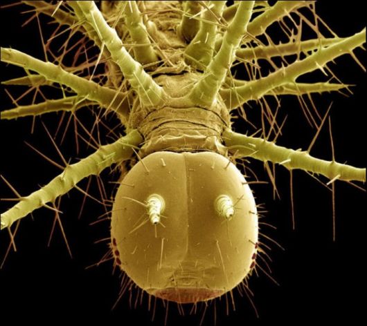 Microscopic Macro Pictures of Insects